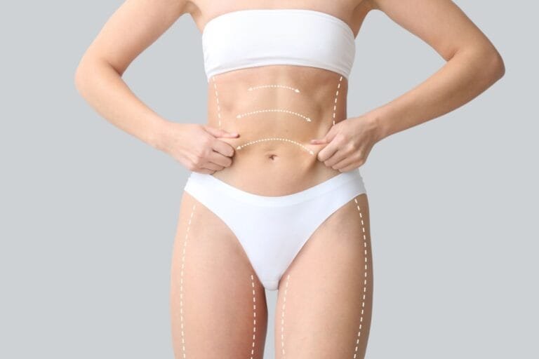 Abdominoplastia circunferencial: saiba tudo sobre