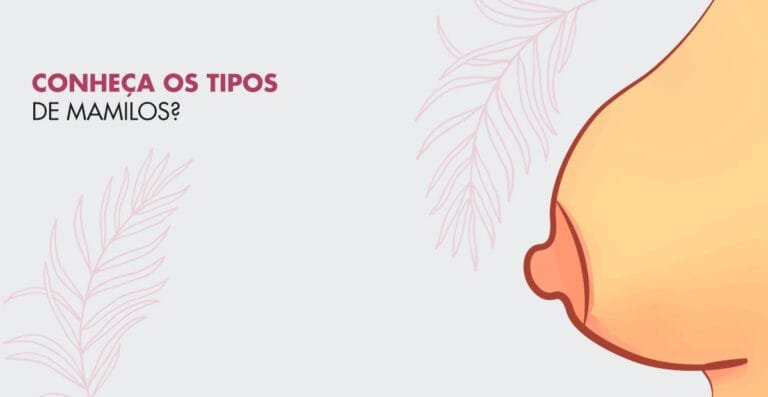 5 Tipos de Mamilos: decubra qual é o seu e dicas sobre a cirurgia de mamiloplastia!
