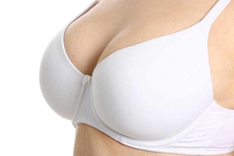 Médico para redução de mama em São Paulo