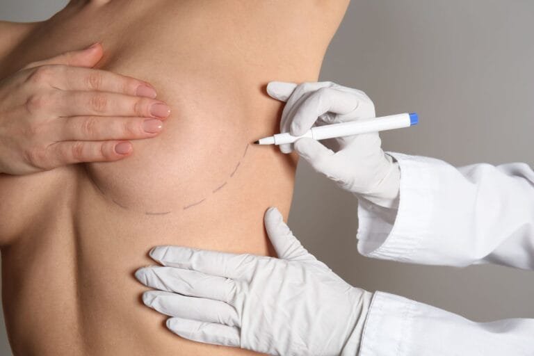 A mamoplastia de recuperação rápida é segura?