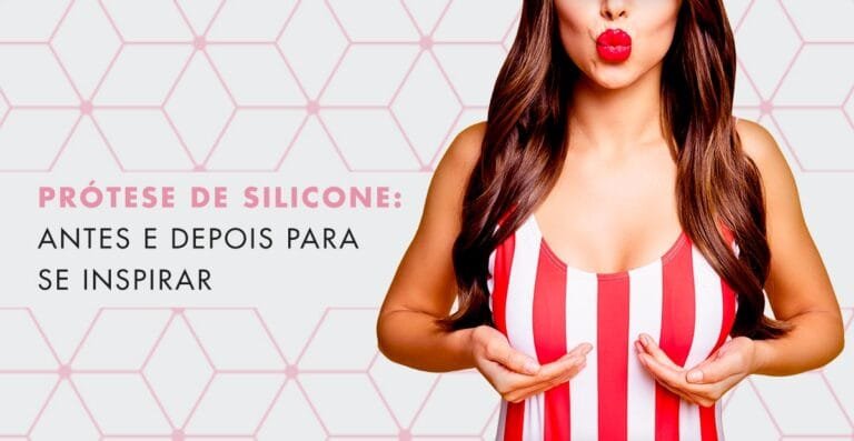 Busca por fotos de silicone antes e depois?