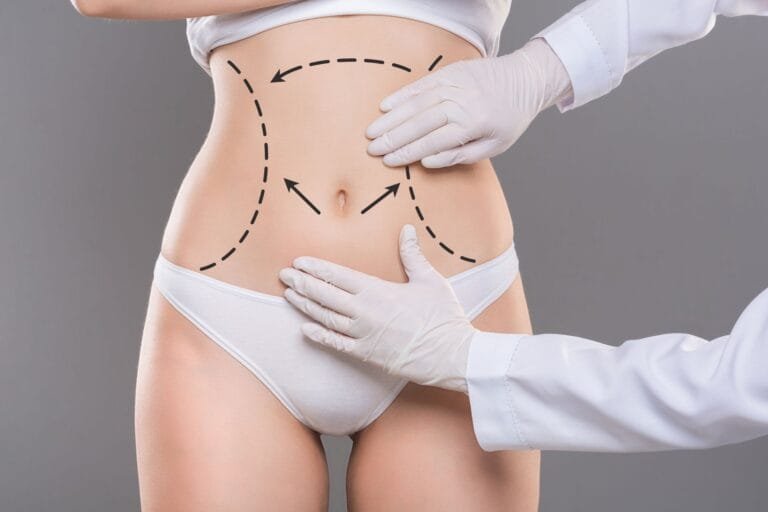 Qual a diferença de abdominoplastia e Lipoabdominoplastia?