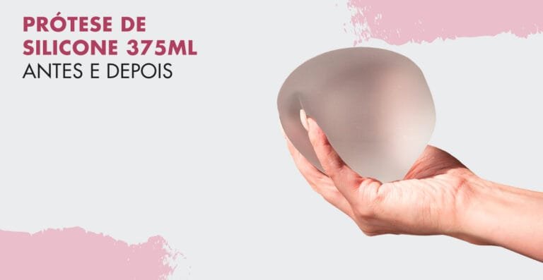 Silicone 375 ml: antes e depois e dicas de especialistas para você fazer a melhor escolha!